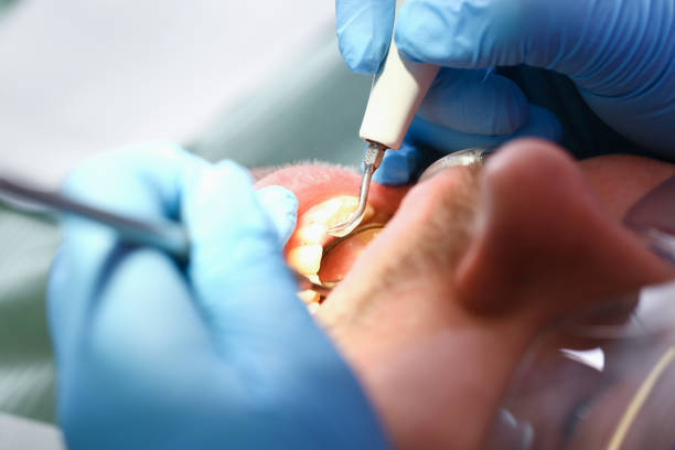 Professional Emergency Dental Service in MI