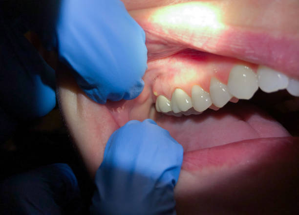 Best Walk-In Emergency Dental Services in Utica, MI